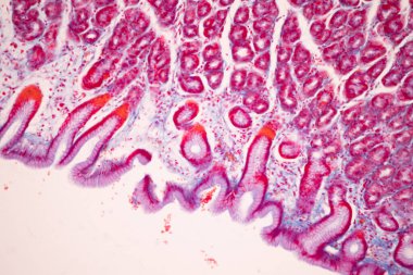 Tissue of Small intestine (Duodenum), Large intestine Human and Stomach Human under the microscope in Lab.