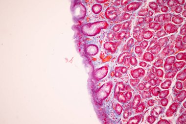 Tissue of Small intestine (Duodenum), Large intestine Human and Stomach Human under the microscope in Lab.
