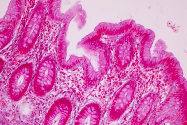 Tissue of Small intestine (Duodenum), Large intestine Human and Stomach Human under the microscope in Lab.