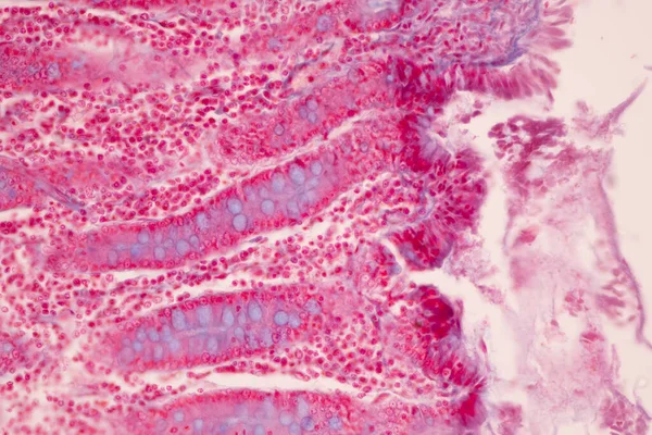 Tissue Small Intestine Duodenum Large Intestine Human Stomach Human Microscope lizenzfreie Stockbilder