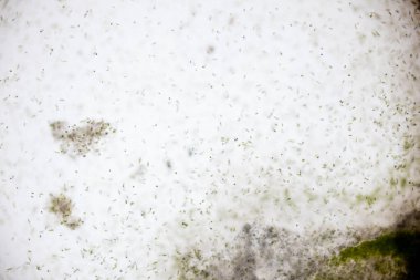 Reproductive cells of Flowering Plants under microscopic.