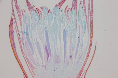 Reproductive cells of Flowering Plants under microscopic.
