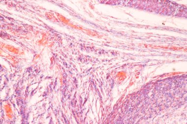 Anatomi ve Tarih Kemiği, Elastik kıkırdak insan ve insan fetüsünün birleşimi eğitim mikroskobu altında.