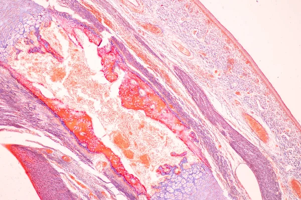 Anatomia Ossa Istologiche Cartilagine Elastica Umana Articolazione Del Feto Umano — Foto Stock