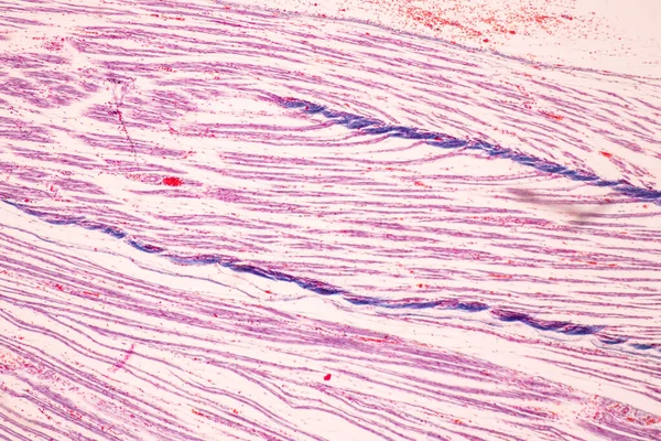 Anatómia Szövettani Csont Rugalmas Porc Emberi Ízületi Emberi Magzat Mikroszkóp — Stock Fotó