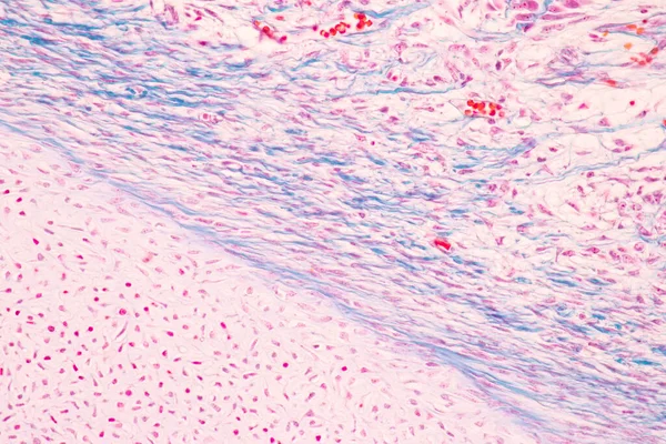 Anatómia Szövettani Csont Rugalmas Porc Emberi Ízületi Emberi Magzat Mikroszkóp — Stock Fotó