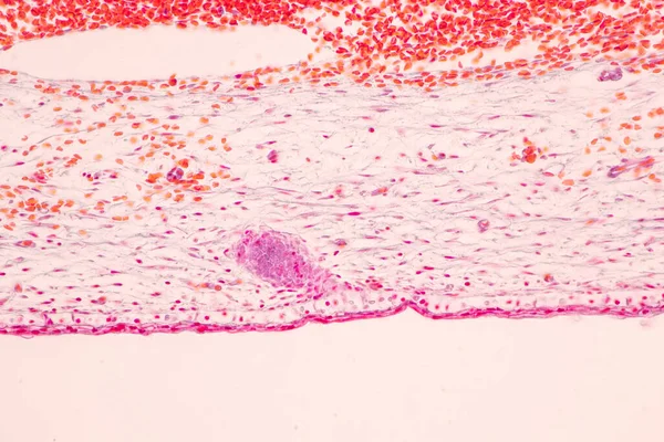 Anatomy Histological Bone Elastic Cartilage Human Joint Human Foetus Microscope — Stock Photo, Image