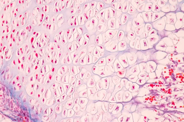 Anatomie Histologická Kost Elastická Chrupavka Člověk Kloub Lidského Plodu Pod — Stock fotografie