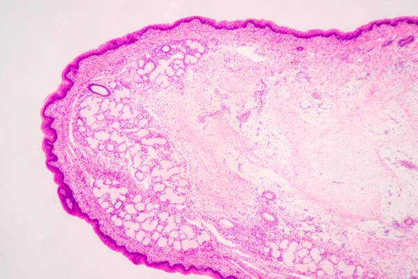 Anatomie Histologisch Bot Elastisch Kraakbeen Menselijk Gewricht Van Menselijke Foetus — Stockfoto