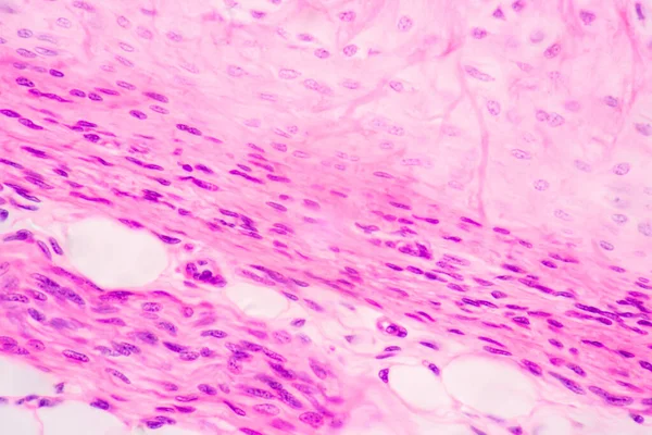 Anatomie Histologique Cartilage Élastique Humain Articulation Fœtus Humain Sous Microscope — Photo