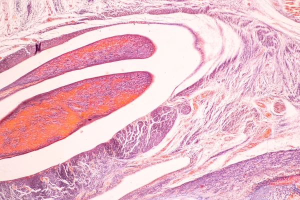 Anatomy Histological Bone Elastic Cartilage Human Joint Human Foetus Microscope Stock Picture