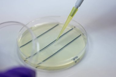 Laboratuvardaki karideslerdeki bakterilerin analizi.