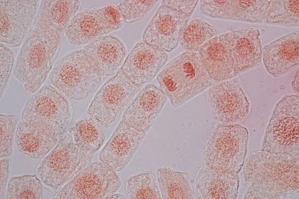 Mitóza Buňky Kořenové Špičce Cibule Pod Mikroskopem — Stock fotografie