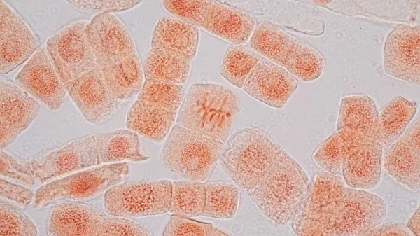 Клетки Митоза Кончике Корня Лука Микроскопом — стоковое фото