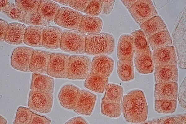 Mitosezelle Der Wurzelspitze Der Zwiebel Unter Dem Mikroskop — Stockfoto