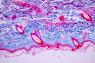 İnsan kafa derisinin karakteristik özellikleri genel vücut yüzeyinden insan derisi ve mikroskop altında ter bezlerini gösteriyor..