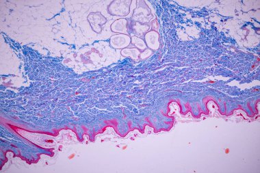 İnsan kafa derisinin karakteristik özellikleri genel vücut yüzeyinden insan derisi ve mikroskop altında ter bezlerini gösteriyor..