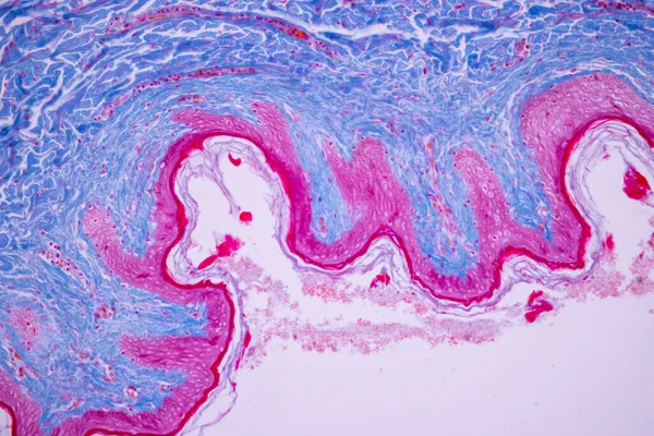 ヒトの頭皮の特徴的なティッシュの背景 一般的な体表面からの皮膚の人間および顕微鏡の下で汗腺を示す — ストック写真