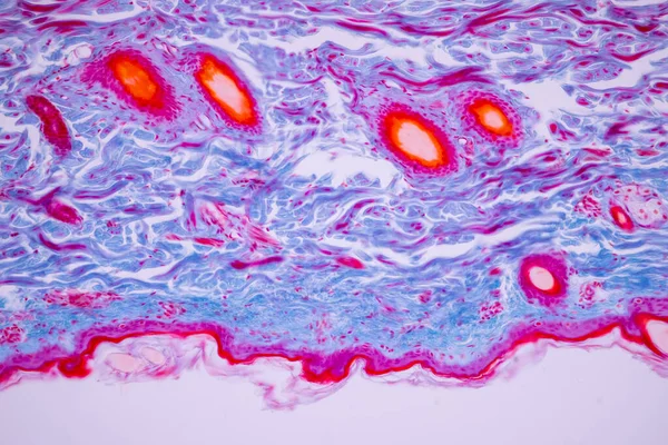 ヒトの頭皮の特徴的なティッシュの背景 一般的な体表面からの皮膚の人間および顕微鏡の下で汗腺を示す — ストック写真