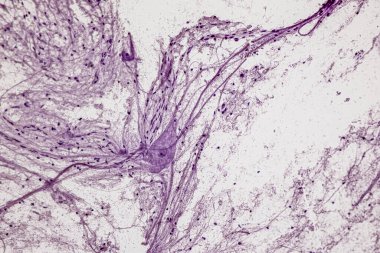 Laboratuvarda mikroskop altında motor nöron, omurilik, sinir lifleri ve sinir hücreleri..