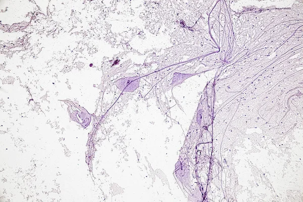 モーター ネオロン Nerve繊維および神経細胞 ラボの顕微鏡の下で ストック写真