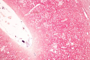 Laboratuvarda mikroskop altında insan sinir sistemi.