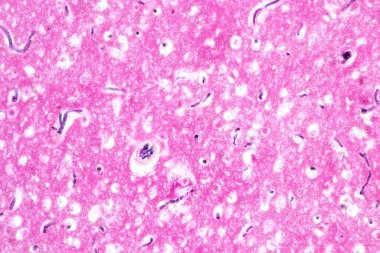 Laboratuvarda mikroskop altında insan sinir sistemi.