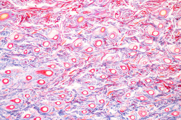 Backgrounds of Characteristics Tissue of Human scalp, Skin human from general body surface and showing sweat glands under microscope.