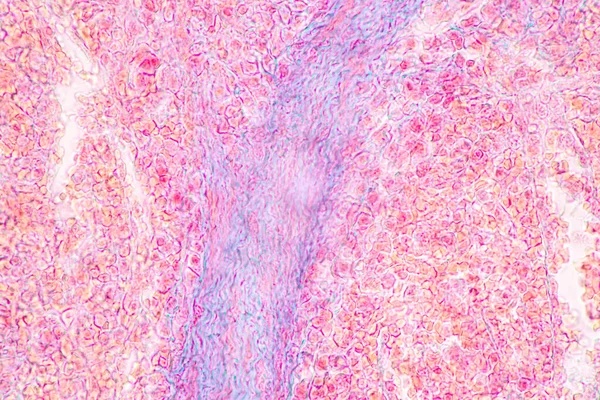 Structure of Tissue of Spleen Human, Liver Human and Kidney Human under the microscope in Lab.