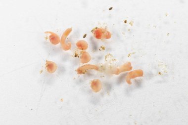 Mikroskop altında deniz balıklarının Parazit helminitleri (Trematodes) araştırması.