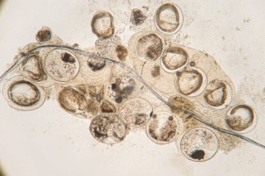 Mikroskop altında deniz balıklarının Parazit helminitleri (Trematodes) araştırması.