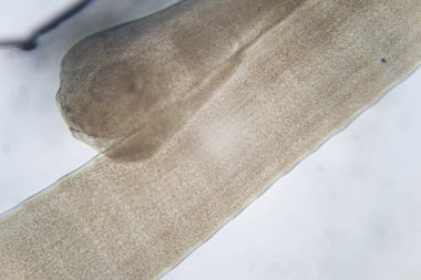 Tenyalar (Cestoda: Caryophyllidea), Tayland 'daki Balık Parazitleri.