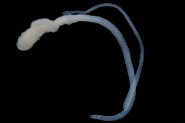 Tenyalar (Cestoda: Caryophyllidea), Tayland 'daki Balık Parazitleri.