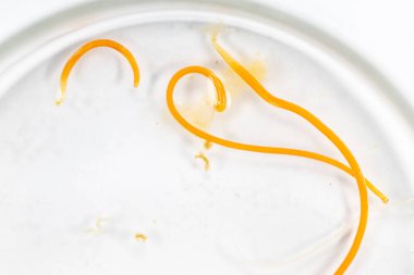 Mikroskop altında Parazit helminatlar (Trematodlar) ve Ascaris balıklarının çalışmaları.