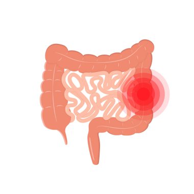 cartoon intestinal tract like irritable bowel syndrome icon. logotype design of unhealthy gut sign or internal organ of digestive system pictogram. flat graphic element isolated on white background