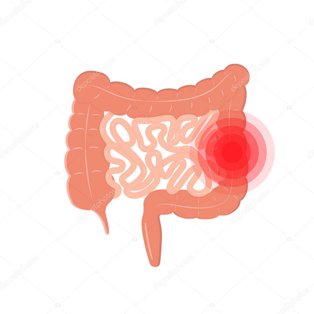 Cartoon intestinal tract like irritable bowel syndrome icon. logotype design of unhealthy gut sign or internal organ of digestive system pictogram. flat graphic element isolated on white background
