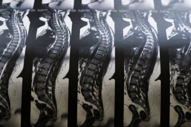 Kadınların manyetik tomografi fotoğrafı.