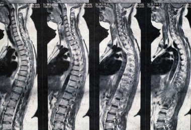 Kadınların manyetik tomografi fotoğrafı.