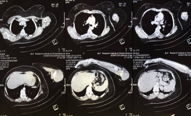 Kadınların manyetik tomografi fotoğrafı.