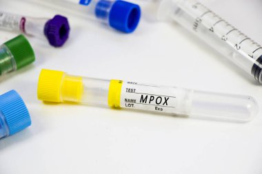Mpox kan testi beyaz arka planda boş tüp örnekleri, stüdyo çekimi. Renkli tüpler, isim, tarih ve test.