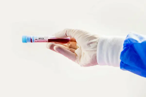 Beyaz arka planda Mpox kan testi tüpleri, stüdyo çekimi. Kan testi örnekleri. Teşhis ve laboratuvar.