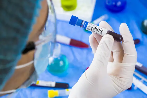 Mpox enfeksiyon testi, doktorlar yüz ve el tüplerinde mavi arka planda kan var. Stüdyo çekimi.