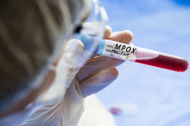 Mpox kan testi beyaz arka planda boş tüp örnekleri, stüdyo çekimi. Renkli tüpler, isim, tarih ve test.