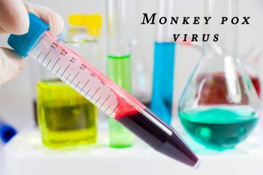 Mpox maymun çiçeği virüsü, laboratuvar ve kan testi tüpü
