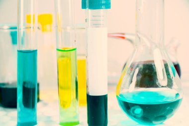 İnsan Metapnömotorirüsü, HMPV virüsü kanı ve laboratuvarda yapılan diğer testler