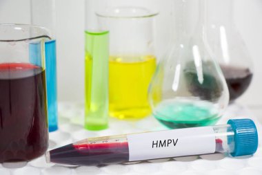 İnsan Metapnömotorirüsü, HMPV virüsü kanı ve laboratuvarda yapılan diğer testler