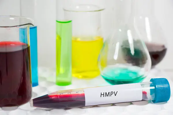 İnsan Metapnömotorirüsü, HMPV virüsü kanı ve laboratuvarda yapılan diğer testler