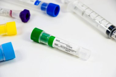 İnsan Metapneumovirüs, laboratuvarda HMPV virüsü testi