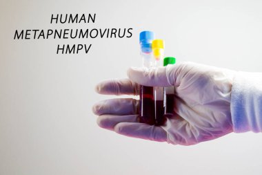 Human Metapneumovirus, HMPV virus test in lab clipart