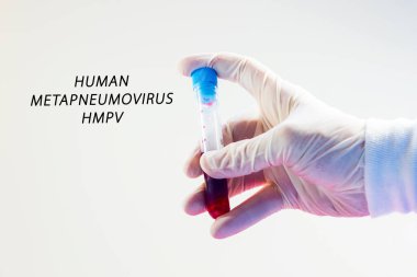 İnsan Metapneumovirüs, laboratuvarda HMPV virüsü testi